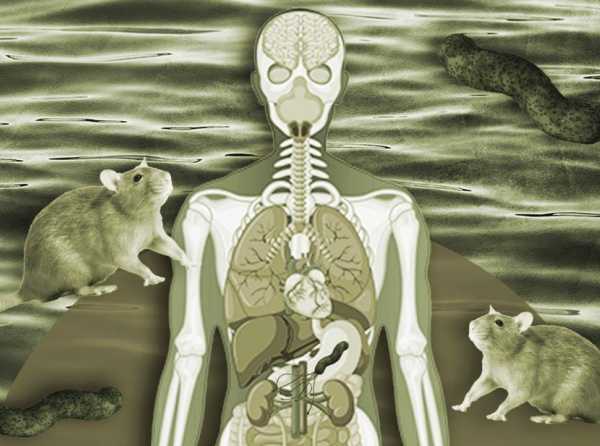 Salud P&uacute;blica, leptospirosis y el Minsa