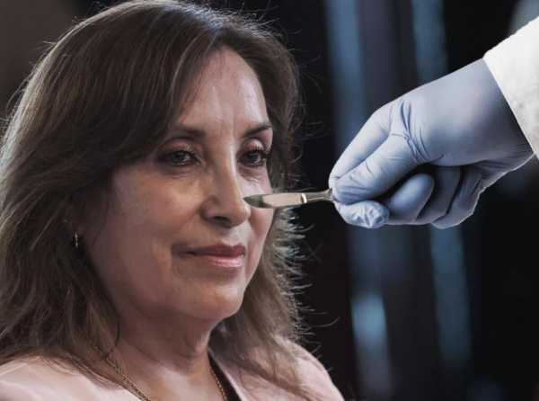 La rinoplastia y el apuro de investigar a Boluarte